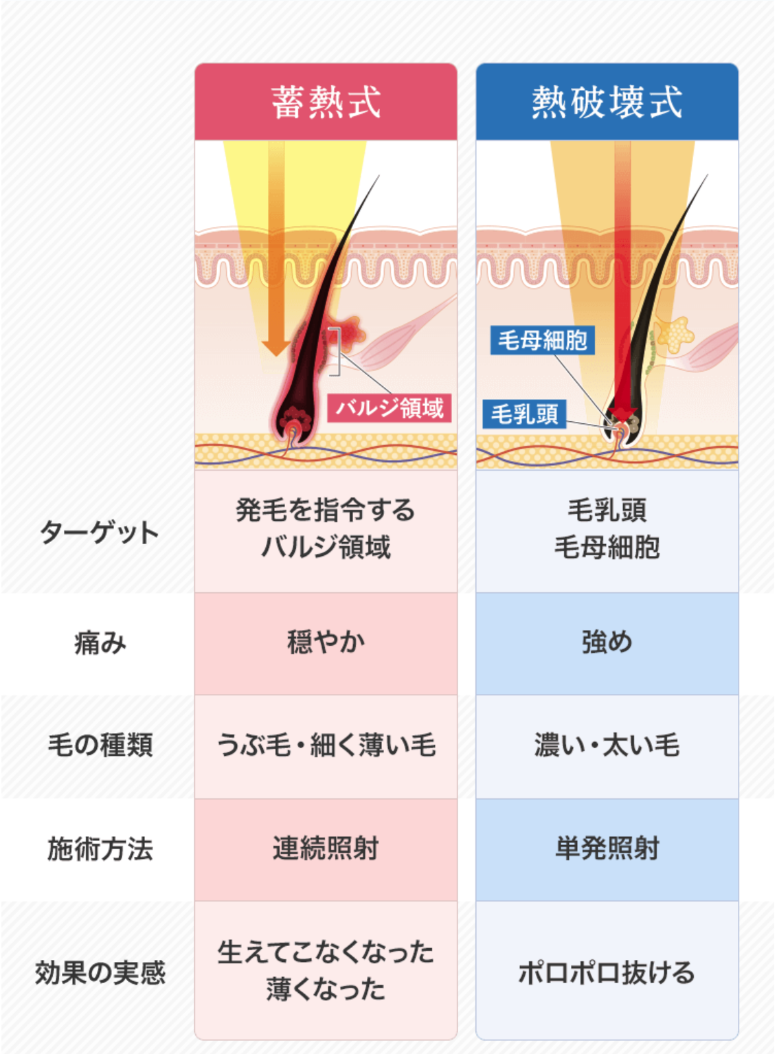 ２種類の脱毛器